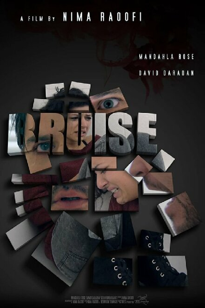 Bruise