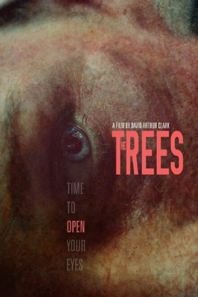 The Trees
