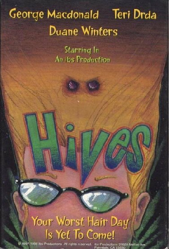 Hives