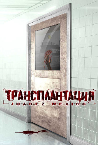 Трансплантация