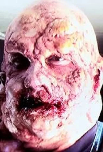 Onionhead
