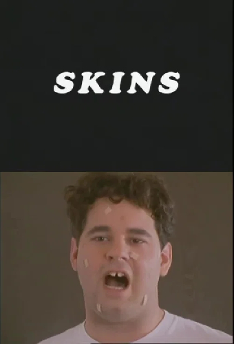 Skins
