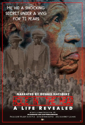 Hole in the Head: A Life Revealed