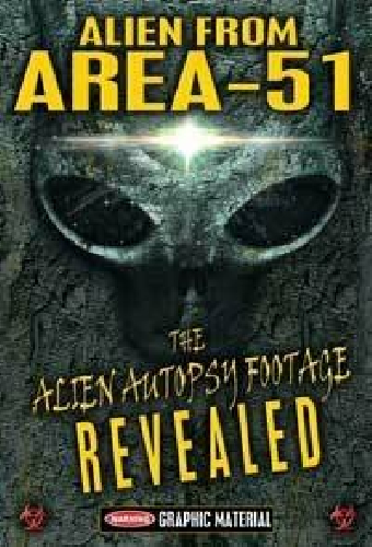 Alien from Area 51: The Alien Autopsy Footage Revealed