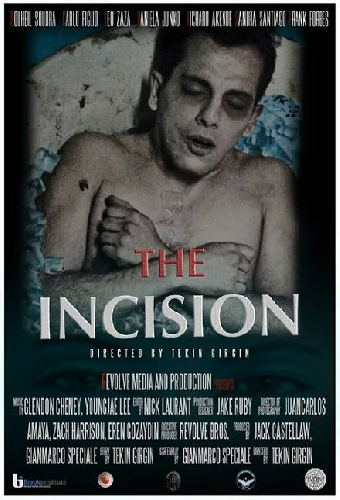 The Incision