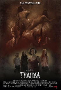 Травма