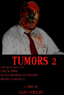 Опухоли 2
