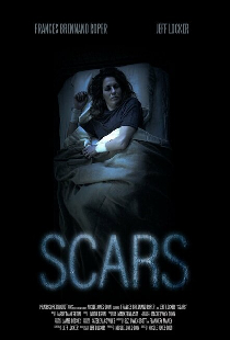 Scars