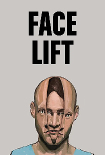 Facelift