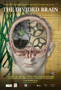 The Divided Brain