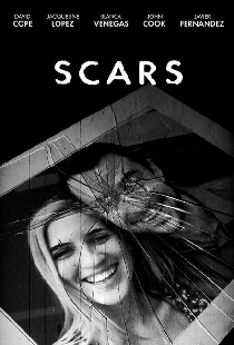Scars