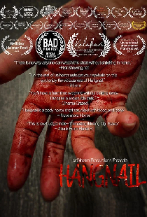 Hangnail