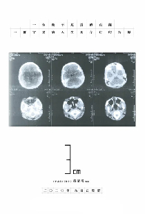 3cm