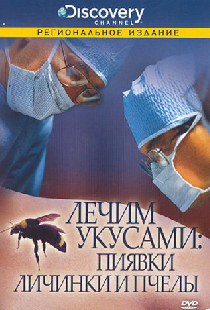 Discovery: Лечим укусами. Пиявки, личинки и пчелы