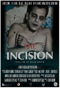 The Incision