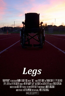 Legs